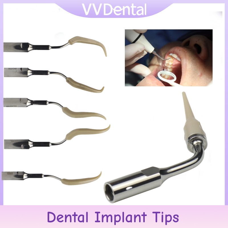Tips Implan Ultrasonic Scaler  - Teeth Whitening Tips ulasan dan harga