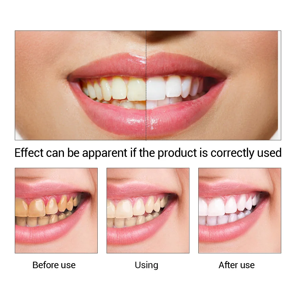 FTEENPLY Bubuk Esensi Pemutih  - Teeth Whitening Cream ulasan dan harga
