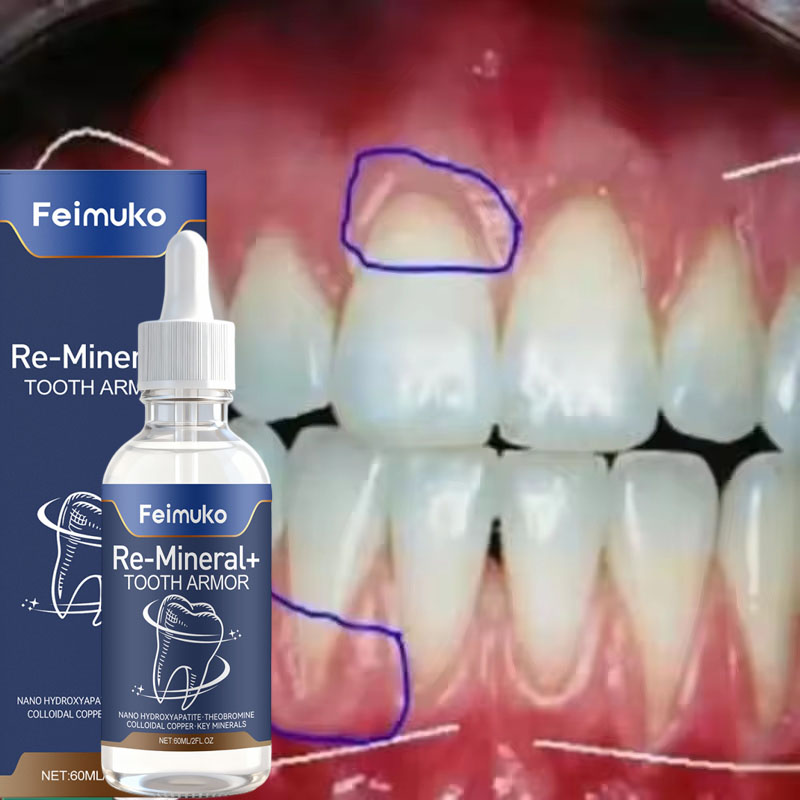 Serum Perawatan Perbaikan Gusi - Teeth Whitening Gingival Barrier ulasan dan harga