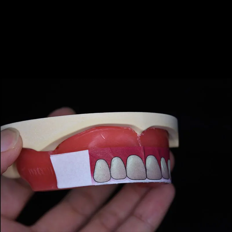 Stiker pemosisian Dental penuh - Teeth Whitening Tray ulasan dan harga